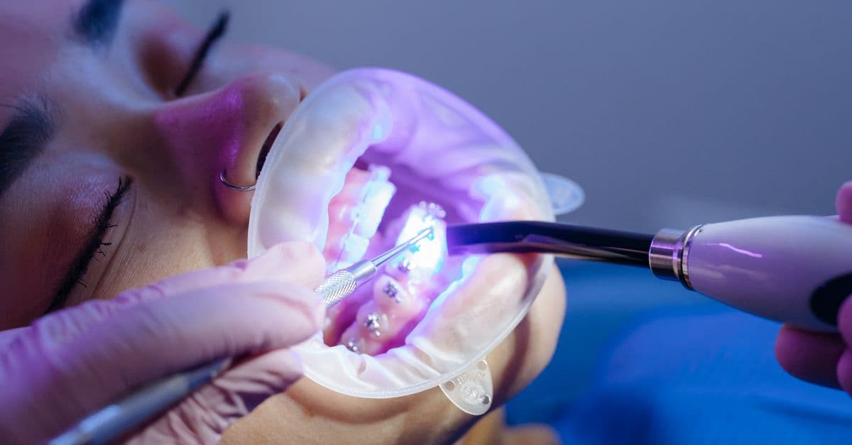 Pediatric Orthodontic Treatment Planning Assistant